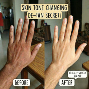 Home Skincare Transformation